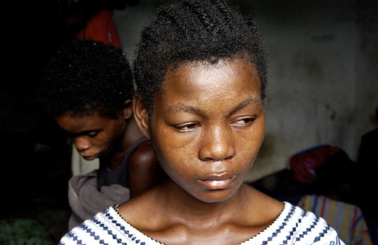patient at psychiatric facility liberia.jpg